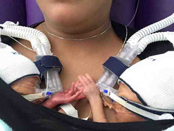 Čudo i ljepota života: Prijevremeno rođeni blizanci se drže za ručice