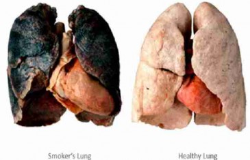 PREVARENI SMO? CRNA PUŠAČKA PLUĆA NE POSTOJE: Mnogi stogodišnjaci pušili su i 60 cigareta dnevno!