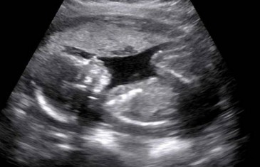 U 9. mjesecu trudnoće obavila ultrazvuk, doktori nisu mogli da vjeruju šta ”vide”!