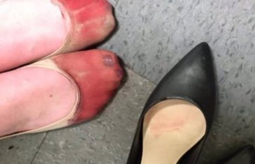 Ova fotografija konobarice sa krvavim nogama zgrozila internet