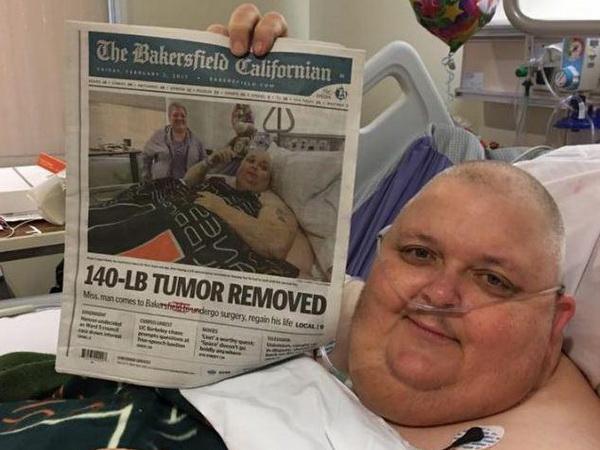 FOTO / SAD: Muškarcu uspješno odstranjen tumor težak gotovo 59 kilograma.