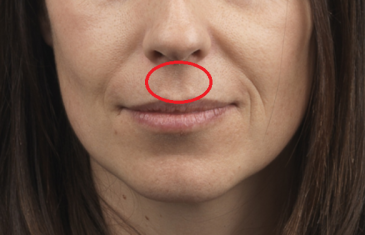 Imate li šupljinu između nosa i gornje usne? Ostat ćete u čudu kad pročitate šta to znači…