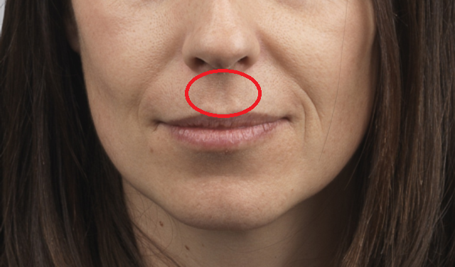 Imate li šupljinu između nosa i gornje usne? Ostat ćete u čudu kad pročitate šta to znači…