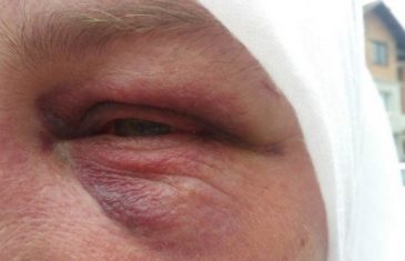 Potresna ispovijest pokrivene žene koja je napadnuta u Kiseljaku: Vlasnik kafića je čuo ‘Allahimanet’ i onda…
