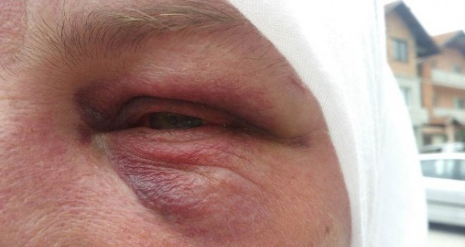 Potresna ispovijest pokrivene žene koja je napadnuta u Kiseljaku: Vlasnik kafića je čuo ‘Allahimanet’ i onda…