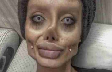 Sjećate li se deformisane dvojnice Angeline Jolie? Evo kako je izgledala prije silnih transformacija – nećete vjerovati!