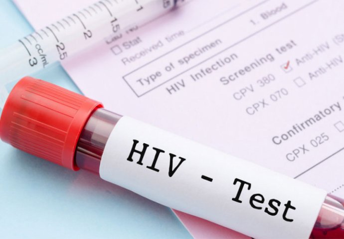 Žena u Vojvodini zaražena HIV-om nakon transfuzije krvi
