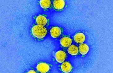 EVO KAKO IZGLEDA KORONAVIRUS: Opasni uzročnik pandemije snimljen elektronskim mikroskopom