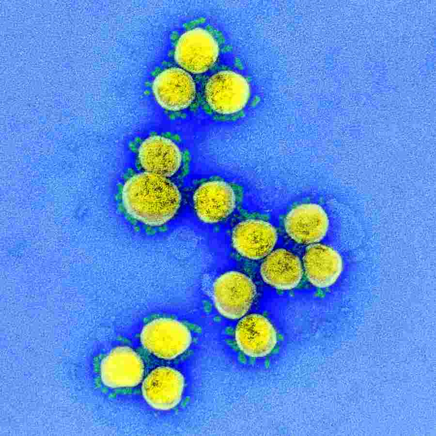 EVO KAKO IZGLEDA KORONAVIRUS: Opasni uzročnik pandemije snimljen elektronskim mikroskopom