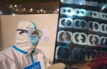 OVO NISMO OČEKIVALI: Doktorica uporedila pluća poslije korona virusa i pluća pušača