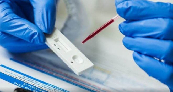 Intrigantno otkriće može promijeniti sve: Vaš test na koronavirus je pozitivan? Možda se ne bi trebao tako tumačiti…