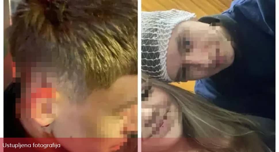 Ispovijest roditelja i djece povrijeđenih u Sarajevu; Napali su nas palicama – imam kopče na glavi i potres mozga