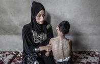 (UZNEMIRUJUĆE)Izrael provodi “reproduktivni genocid” nad Palestincima