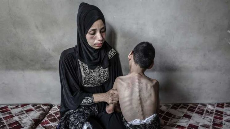 (UZNEMIRUJUĆE)Izrael provodi “reproduktivni genocid” nad Palestincima